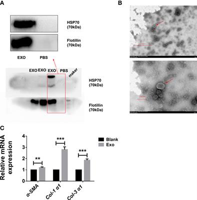 A Novel miRNA From Egg-Derived Exosomes of Schistosoma japonicum Promotes Liver Fibrosis in Murine Schistosomiasis